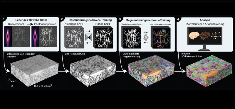Eine Pipeline zur Rekonstruktion von lebendem Hirngewebe. Aufnahme von Mikroskopie mit optimiertem Laserfokus – Bildverarbeitung (DL) – Segmentierung (DL) – visuelle 3D-Analyse.