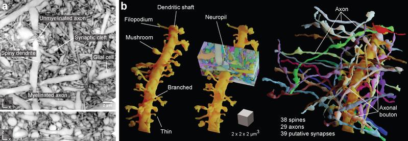 LIONESS delineates the complexity of dense brain tissue. a: Complex neuronal environment b: LIONESS can image and reconstruct the sample in a way that clarifies many dynamic structures and functions in live brain tissue.