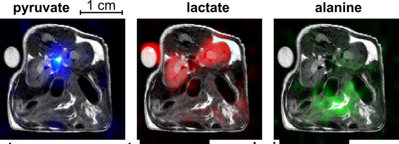 MRI image of a mouse: The hyperpolarized pyruvate (blue) is broken down into lactate and alanine. The time course, location and concentration of the process can be observed in the MRI.