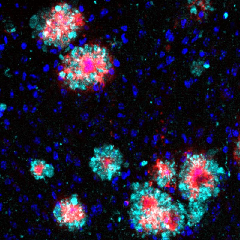 Gehirnschnitt einer Alzheimer-Maus: Das Protein Arl8b (türkis) zeigt eine Anhäufung um die Amyloid-b-Aggregate (rot). Zellkerne sind blau angefärbt. Der Schnitt wurde mit Immunofluoreszenz analysiert.
