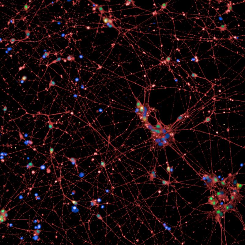 Aus menschlichen Stammzellen hergestellte Nervenzellen (rot und grün). In orange markierten Zellen ist das Sättigungsgen POMC aktiv. Blau: Zellkerne.