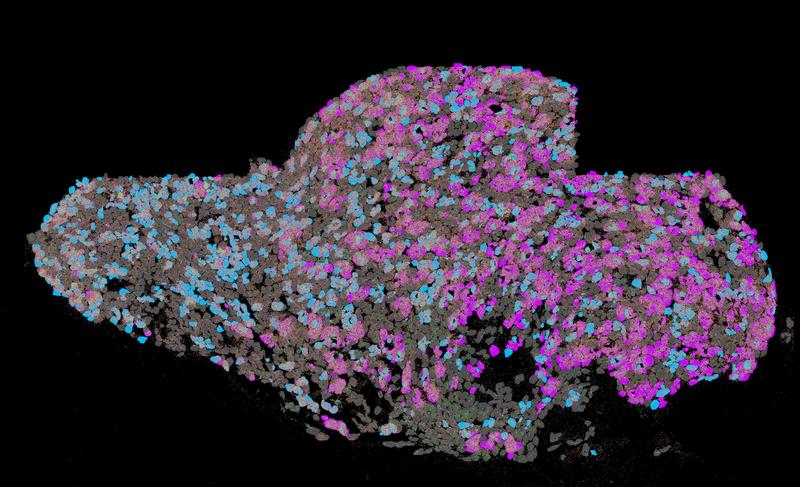 Das obere Halsganglion einer Maus. Hier liegen Nervenzellennen, die den Herzmuskel steuern (pink) in direkter Nähe zur Nervenzellen, die die Zirbeldrüse steuern (blau).