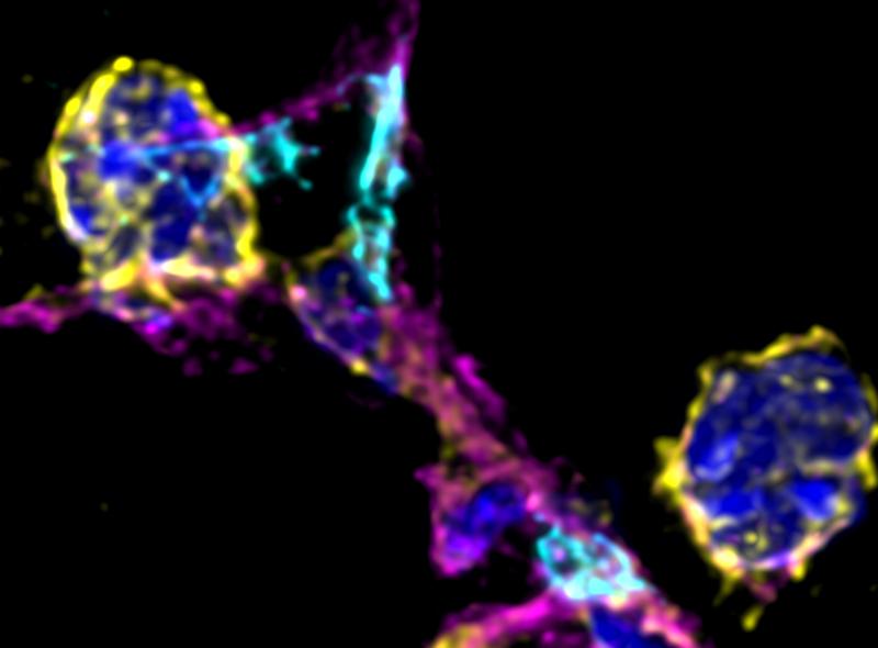 Fluoreszenzmikroskopische Aufnahme zeigt die Interaktion von Thrombozyten (cyan) mit Entzündungszellen (gelb) im Lungengewebe, sowie eine eingewanderte Entzündungszelle außerhalb des Blutgefäßes (magenta) innerhalb des Lungenbläschens. 