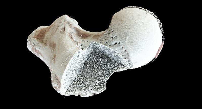 Micro-CT-Aufnahme eines Oberschenkelhalses: Das Projekt OSTEO-MuMo an der Ohm entwickelt eine Simulation zur Darstellung von Umbauprozessen am Knochen. 