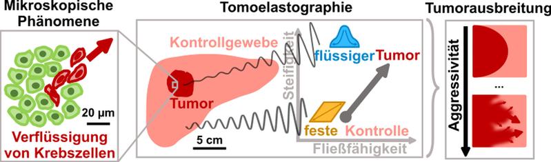 Tumor-assoziiert mikroskopische Effekte wie die Verflüssigung oder erhöhte Fließfähigkeit von Krebszellen haben Einfluss auf die makroskopischen mechanischen Eigenschaften des Tumors. Letztere lassen sich im Körper mit Tomoelastographie messen.