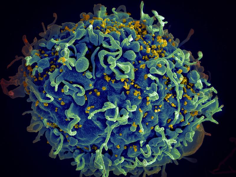 HIV-Virus (gelb) infiziert eine menschliche Zelle