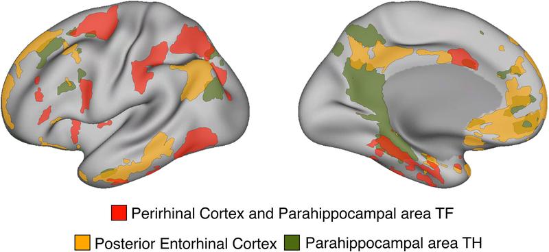 The scientists identified cortical networks associated with the human medial temporal lobe that were unknown to previous memory research.