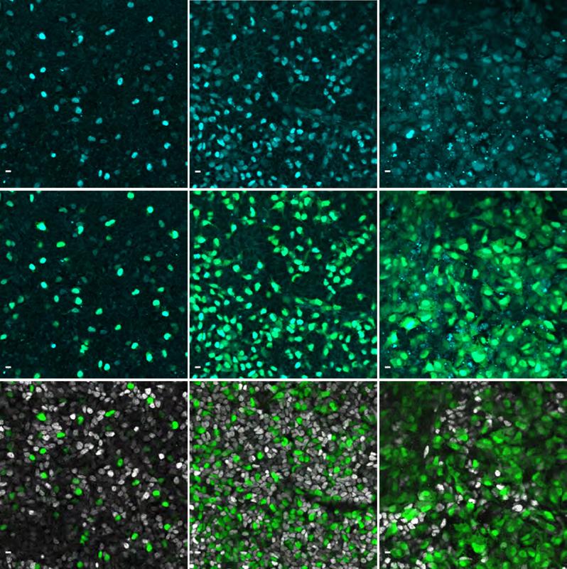 Immunofluoreszenzbilder zeigen das Gen NEUROG3 in Cyan in menschlichen Zellen der Bauchspeicheldrüse.