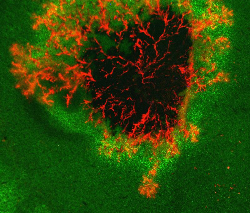 Infektionsstelle des Erregers der Knollenfäule Phytophthora infestans auf einem Blatt. Die sich ausbreitenden Erregerhyphen sind rot-fluoreszierend markiert. Lebendes Blattgewebe ist grün, abgestorbenes Gewebe ist dunkel. Die mikroskopische Anal