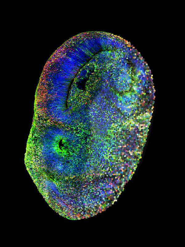 Mikroskopische Aufnahme und künstlerische Darstellung des CHOOSE-Systems in einem menschlichen Gehirnorganoid.