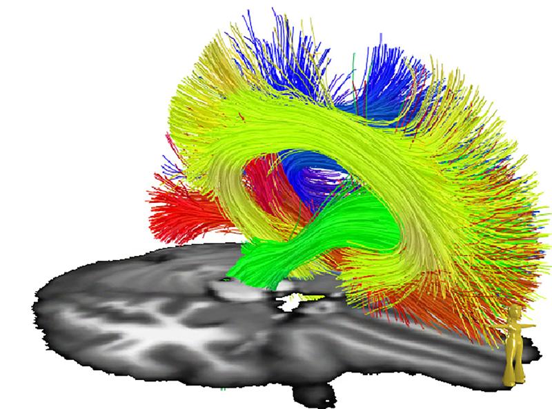 Verlauf einzelner Nervenfasern des Gehirns. Bilder wie diese lassen sich mit dem neu installierten MRT-Gerät in höchster Präzision erstellen.