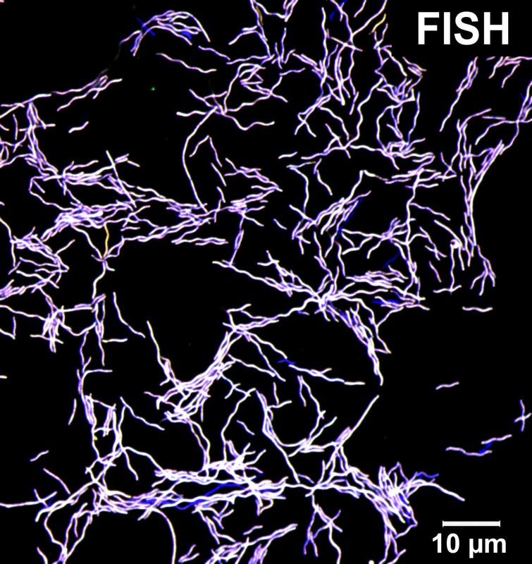  FISH: Fluoreszenzmikroskopisches Bild von Taurinivorans muris in Reinkultur