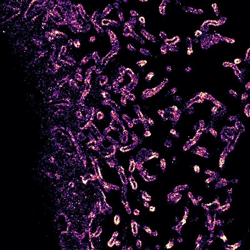 Superhochaufgelöste Zucker in der Glycocalyx auf der Oberfläche von tubulären Membranausstülpungen.