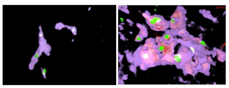 Kupffer-Zell-ähnliche Cluster oder auch Riesenzellen (rechts) übernehmen die Funktion der Kupffer-Zellen (links). Es handelt sich um Ansammlungen multipler Zellen, die netzartige Filter mit hoher Kapazität in den Umgehungsgefäßen bilden.