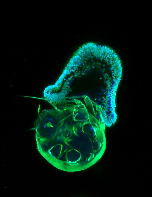 Das Bild zeigt ein frühes Planula-Larvenstadium der Seeanemone Aiptasia (cyanfarbene Kerne und grüne Stachelzellen), das eine Krebspuppe (grün) des Copepoden Tisbe sp. erbeutet.