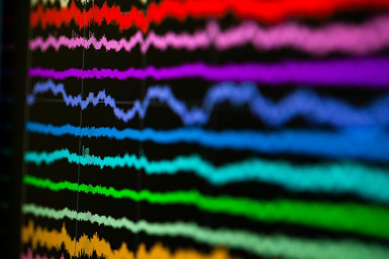 The brain waveforms show when neurons are firing. 