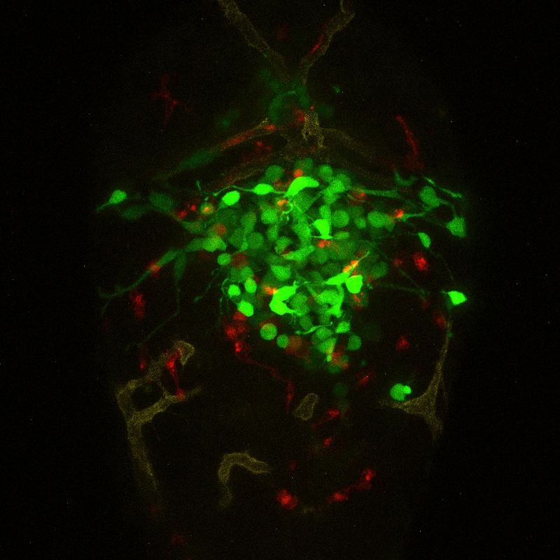 Gehirnregion eines Zebrafisch-Avatars, in dem ein menschliches Glioblastom wächst: Die Tumorzellen von Patient*innen sind grün markiert, das Netzwerk der Blutgefäße gelb und die Makrophagen (Immunzellen) rot. 