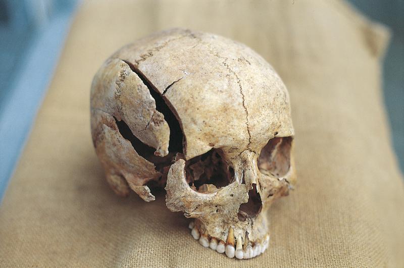A cranial trauma bears witness of a violent death. 
