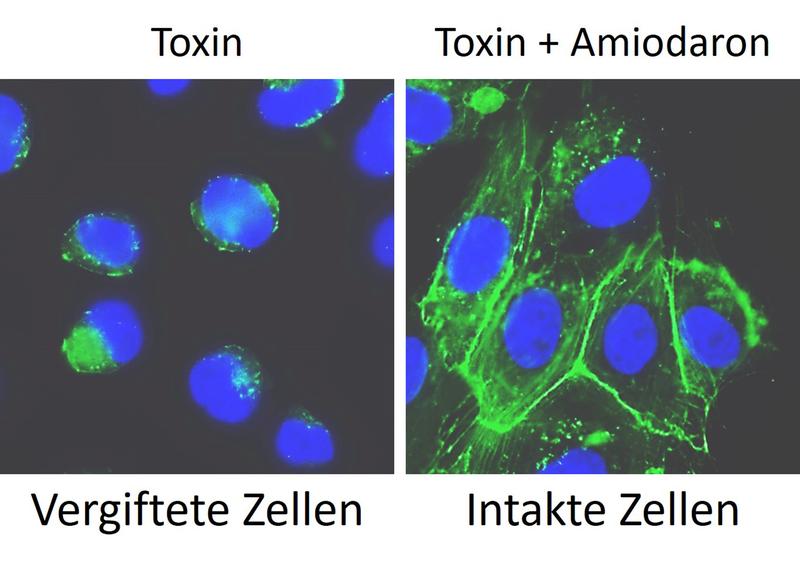 Links: In Zellen, die mit Clostridioides difficile-Toxin TcdB vergiftet wurden, kollabiert das Zellskelett (grün) um den Zellkern (blau) herum. Rechts: In Zellen, die zunächst mit Amiodaron behandelt wurden, beibt das Zellskelett intakt