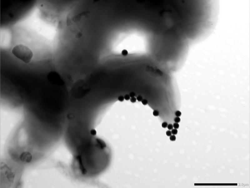 Diese mikroskopische Aufnahme zeigt eine Algenzelle, die versucht, Nanoplastik loszuwerden, was ihr aber nicht gelingt, weil die Partikel klebrig sind. 