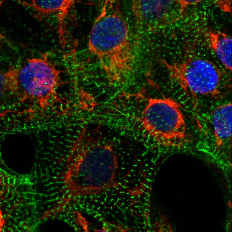 Kardiomyozyten mit angefärbten Mitochondrien (rot), Sarkomeren (grün) und Zellkernen (blau).