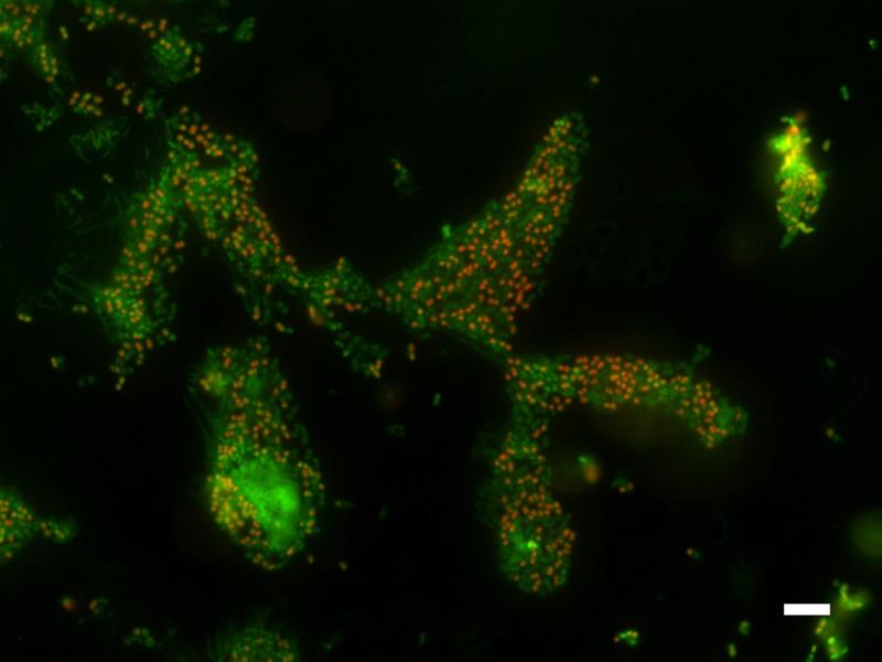 When stressed by high salt concentrations, a number of the cultured Acinetobacter baumannii bacteria die after a few days (orange dots), but many continue to live in a kind of deep sleep (VNBC, green dots).