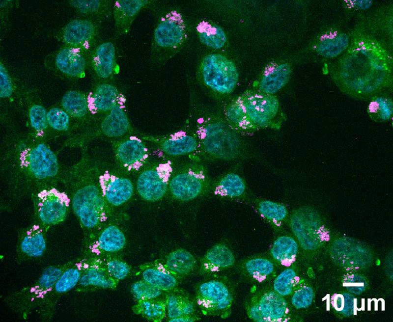 Image of fluorescently labeled nanoparticles (pink) in human colon cancer cells (green) 24 hours after addition to cell culture. Cell nuclei are stained blue.