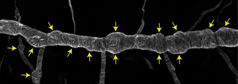 Lichtmikroskopische Aufnahme des Atemorgans eines Drosophila Embryos. Die gelben Pfeile zeigen auf ungewöhnliche Ausbeulungen eines eigentlich glatten röhrenförmigen Tracheenastes. Diese Ausbeulungen können nach kurzer Zeit einreißen.