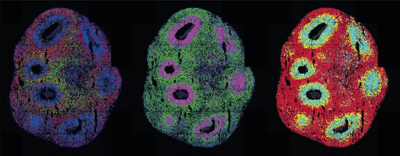 Räumliche transkriptomische Charakterisierung menschlicher zerebraler Organoide. Verschiedenfarbige Punkte zeigen Transkripte verschiedener Gene an, die mit Molecular Cartography (Resolve Biosciences) aufgenommen wurden.