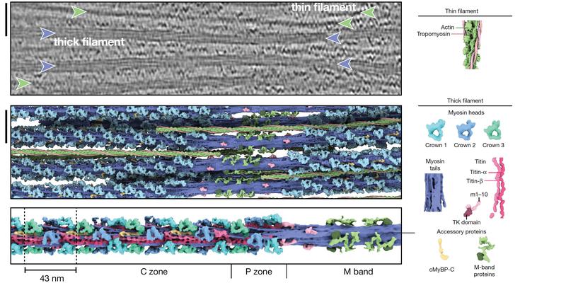 Thick filament structure in the relaxed cardiac sarcomere. The upper image shows a tomographic slice of a cardiac sarcomere. Thin filaments are marked with a green and thick filaments with a purple arrow. The middle, the lower image show a reconstruction.