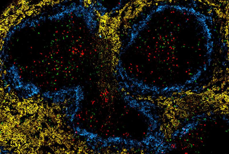  Healthy (red) and exhausted (green) T cells in the spleen of chronically infected mouse.