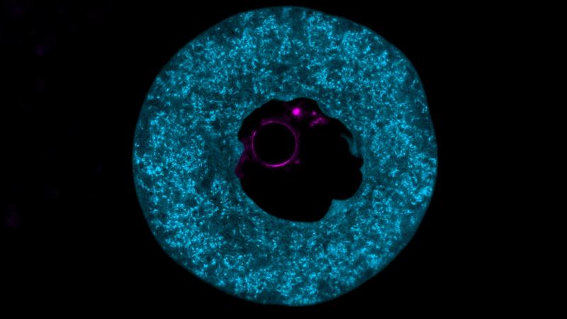 Eine Eizelle einer Maus, die mit dem Protein PADI6 (blau) gefüllt ist – einem Marker und Hauptbestandteil des zytoplasmatischen Gitters. Die DNA im Zellkern ist in magenta dargestellt. 