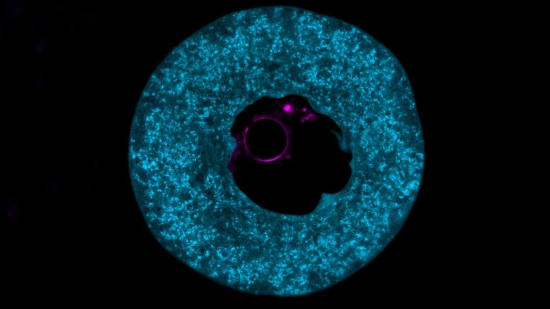 Eine Eizelle einer Maus, die mit dem Protein PADI6 (blau) gefüllt ist – einem Marker und Hauptbestandteil des zytoplasmatischen Gitters. Die DNA im Zellkern ist in magenta dargestellt. 