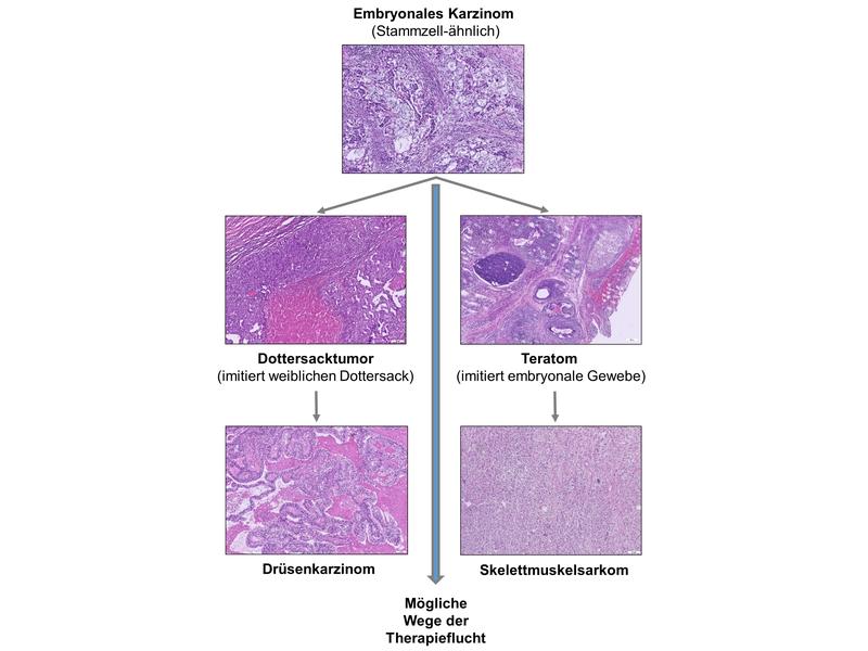 Schematische Darstellung des Weges der Therapieflucht bei Hodentumoren. Aus einem Stammzell-ähnlichen Tumor (embryonales Karzinom) können sich Dottersacktumoren (links) oder Teratome (rechts) entwickeln. 