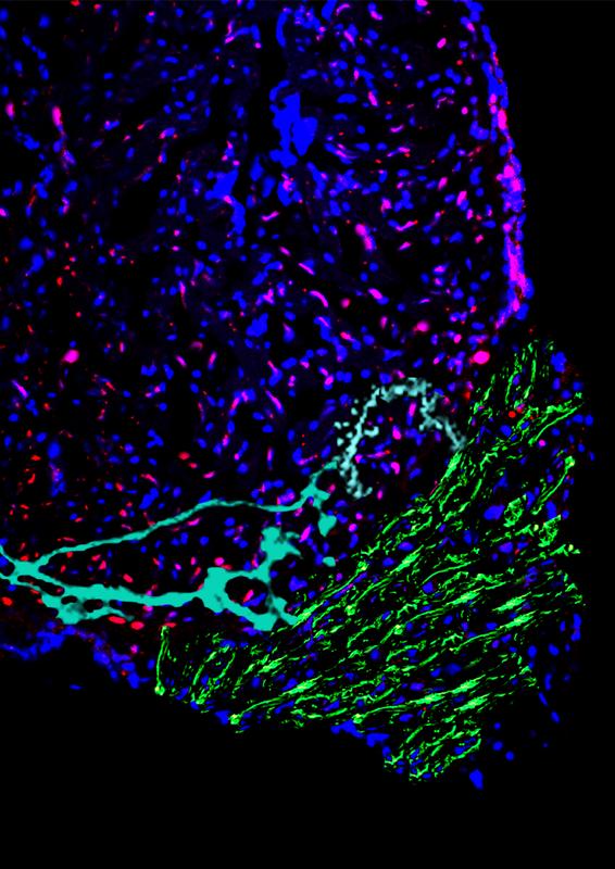 Schnitt durch ein verletztes Zebrafischherz: Immunofluoreszenz zeigt die zellulären und extrazellulären Komponenten, die für die Erholung des Herzens entscheidend sind.