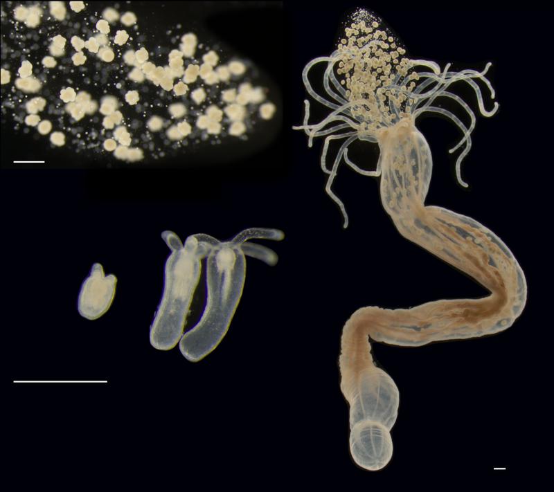 Verschiedene Lebensstadien der Seeanemone Nematostella vectenis. Oben links die Eier, Mitte links verschiedene Wachstumsstadien, rechts das erwachsene Tier. 