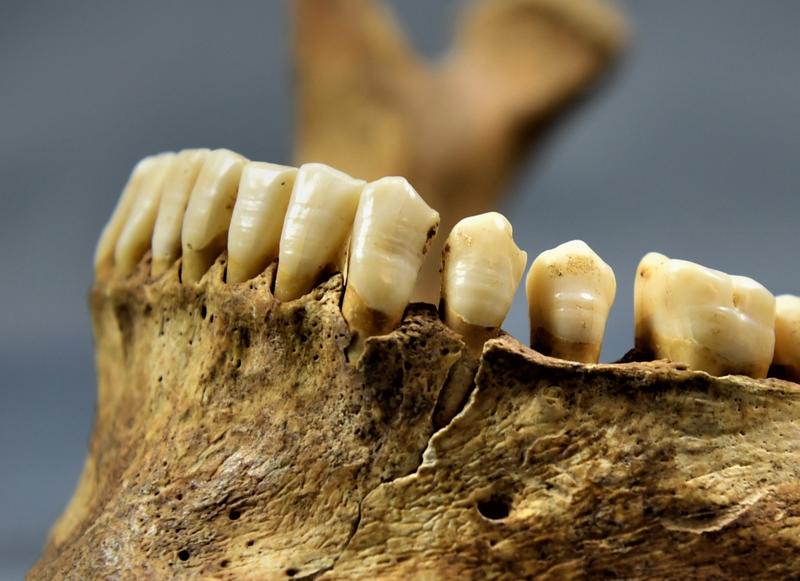 Feine Linien im Zahnschmelz zeigen Stressphasen im Leben der frühmittelalterlichen Menschen an.