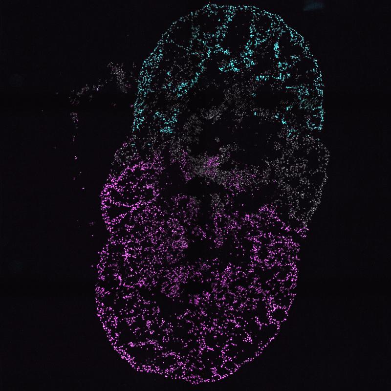 Querschnitt eines Mehrkammer-Kardioids, mit Vorhoforganoid (cyan), linkem Kammerorganoid (weiß) und rechtem Kammerorganoid (magenta). Der Querschnitt verdeutlicht die Hohlräume im Inneren der Mehrkammern-Kardioide. 