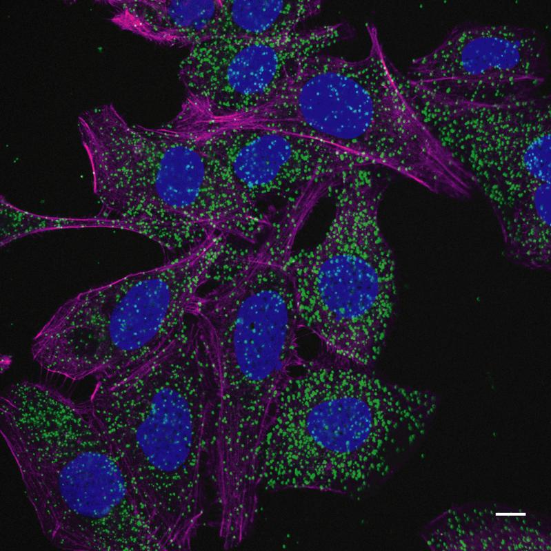 Die grünen Punkte in diesem Fluoreszenzbild zeigen die Bindung des Leukämie-assoziierten NPM1c Proteins an den Recycling-Regulator GABARAP. Blau: Zellkern, Violett: Zellskelett.