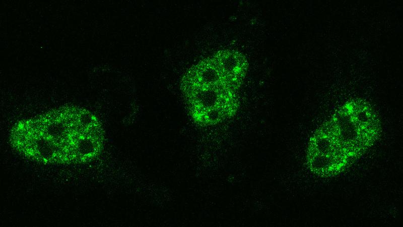 The protein TDP-43 (green) forms small clusters with an important regulatory function in the cell nucleus.