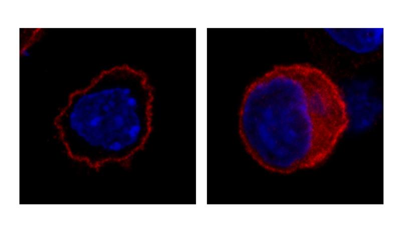 Mittels Immunfluoreszenz wird unter dem Mikroskop sichtbar, dass das intakte SLC4A10-Protein (rot, links) an der Zelloberfläche lokalisiert, während das mutierte Protein überwiegend im Zellinneren bleibt.