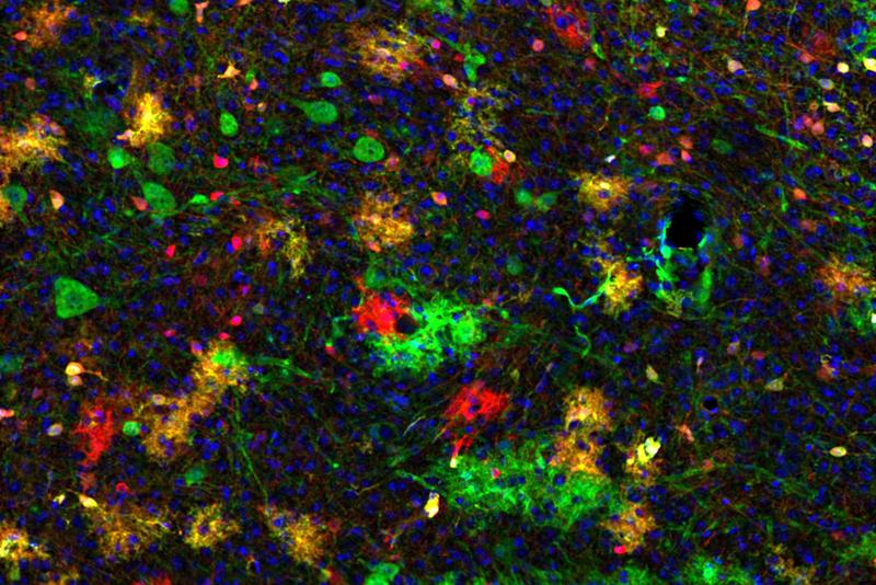 Aufbau der Colliculus superior ohne Pten-Gen. Schnitt durch den Colliculus superior einer Maus, bei dem das Pten-Gen in allen grünen Zellen entfernt wurde, während es in allen roten Zellen während der Entwicklung zum Vergleich intakt blieb.