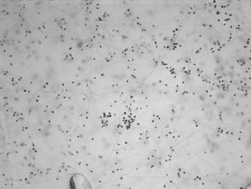 A network of fungal filaments (hyphae) with fungal spores on culture medium 