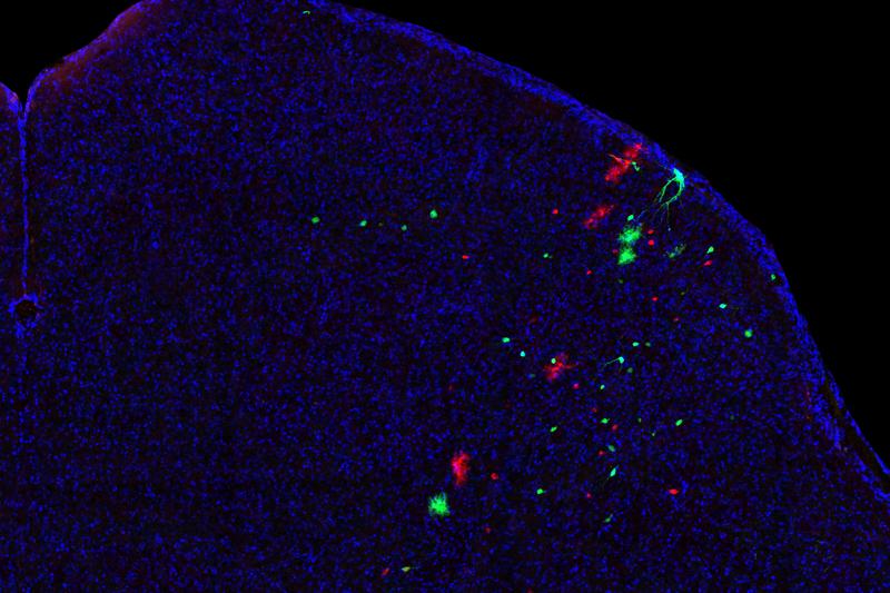 Cells of common origin in the superior colliculus marked by MADM. This section of a mouse superior colliculus shows the progenies of a single neural stem cell marked in fluorescent green or red. Both neurons and glia are shown.