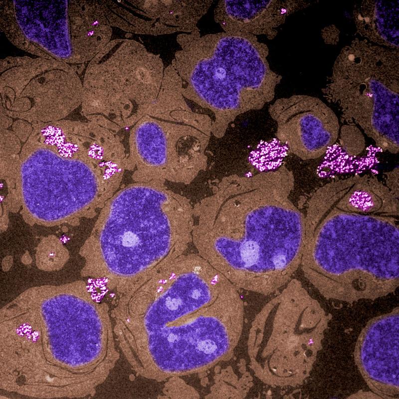 Nanomateralien (pink) können von menschlichen Zellen (Zellkern in blau, Zytosol in braun) aufgenommen werden. 