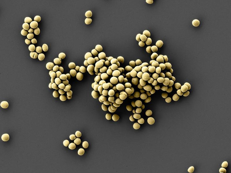 Rasterelektronenmikroskopische Aufnahme des Epifadin produzierenden Bakteriums Staphylococcus epider-midis. Kolorierung: Elke Neudert/Universität Tübingen. 