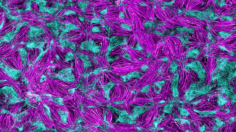 Ein humanes selbst-organisierendes 2D-Modell der neuromuskulären Verbindung. Die Immunfluoreszenzanalyse der gesamten Kulturschale zeigt Muskelzellen (magenta), die in Bündeln organisiert und von Rückenmarksneuronen (cyan) umgeben sind.