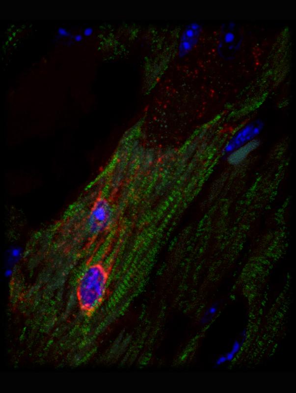 Durch ihre charakteristische Quersteifung (grün) ist die Herzmuskelzelle (Kardiomyozyt) gut erkennbar. Die Virus-Infektion dieser Zelle ist anhand der rot angefärbten viralen RNA gezeigt.