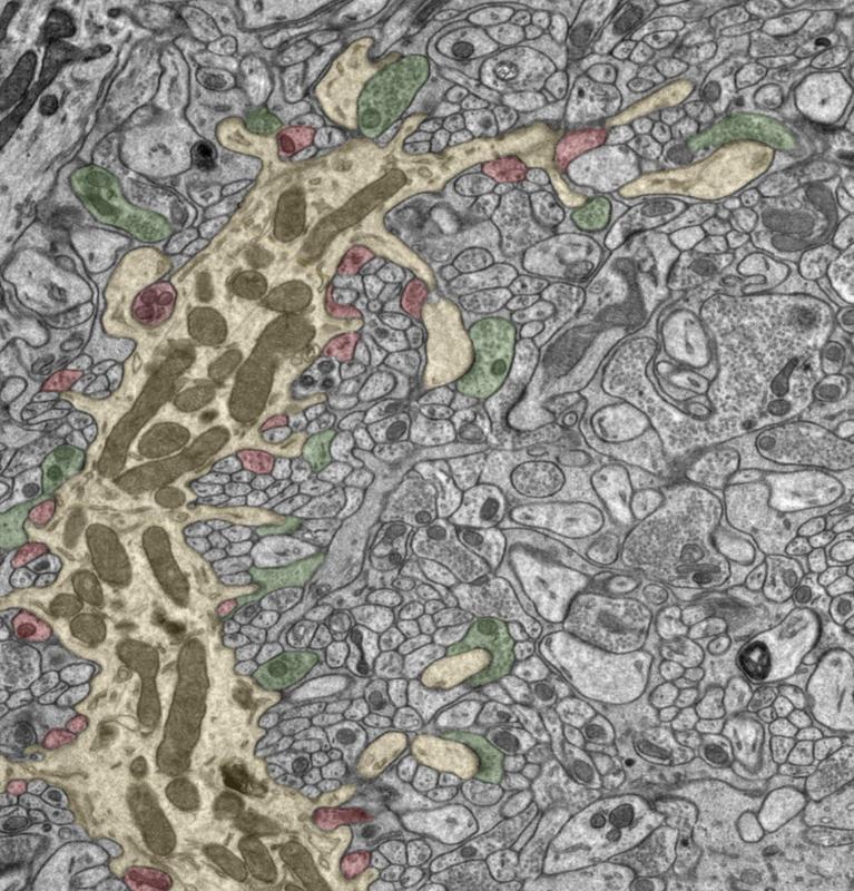 Electron microscope image of neurons in the cerebellum. This slice through the cells in the cerebellum shows a dendritic branch of a Purkinje cell and its side arms (yellow) receiving several excitatory inputs (green) and inhibitory inputs (red).