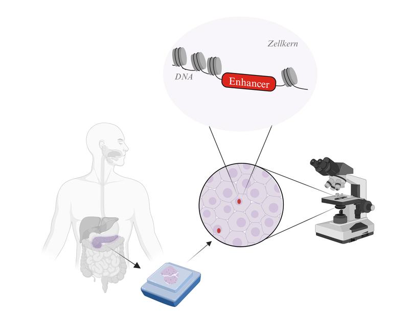 In der Studie ist es erstmals gelungen, die Aktivität von "Enhancern" im Tumormaterial von Patient:innen mit Bauchspeicheldrüsenkrebs zu messen. Die in der DNA enthaltenen Enhancer sind am Tumorwachstum beteiligt und bieten Ansatzpunkte für die Therapie.